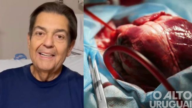 Setembro Verde: doações de órgãos aumentam 36% no RS