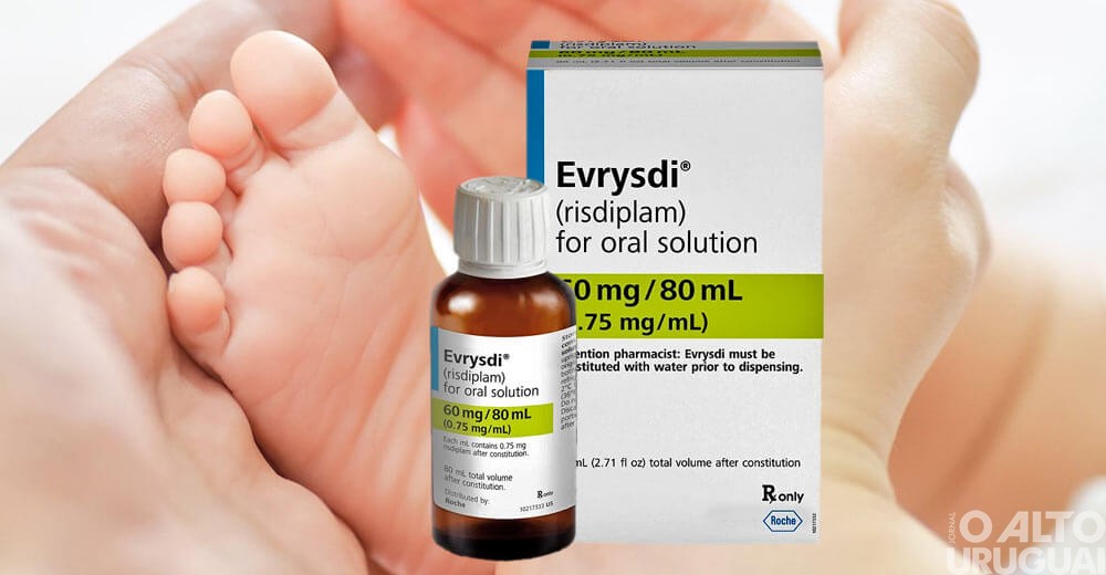 SUS terá novo medicamento para tratamento da AME tipo I e II