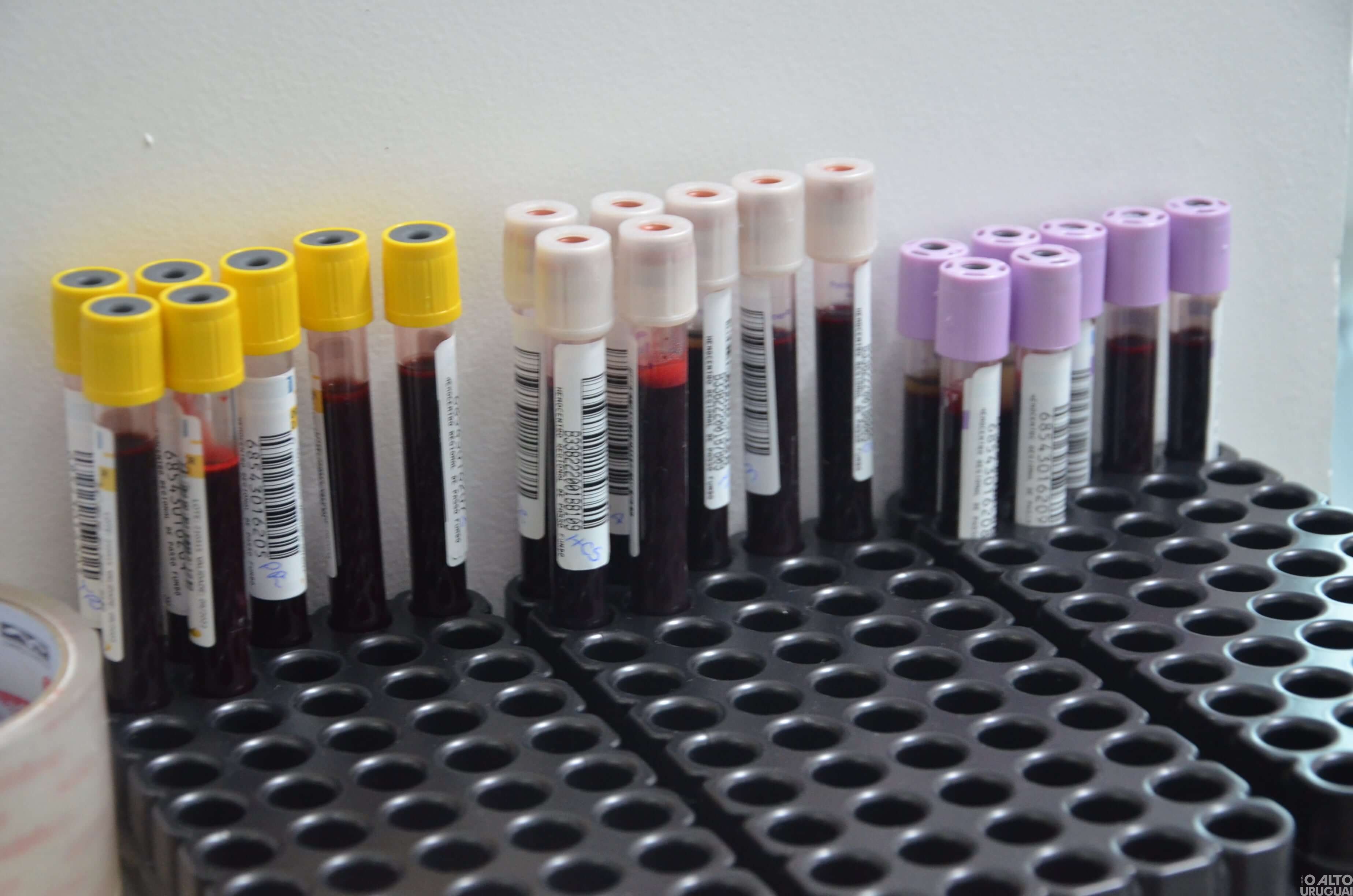 Solenidade marca começo das atividades do Posto de Coleta de Sangue em FW