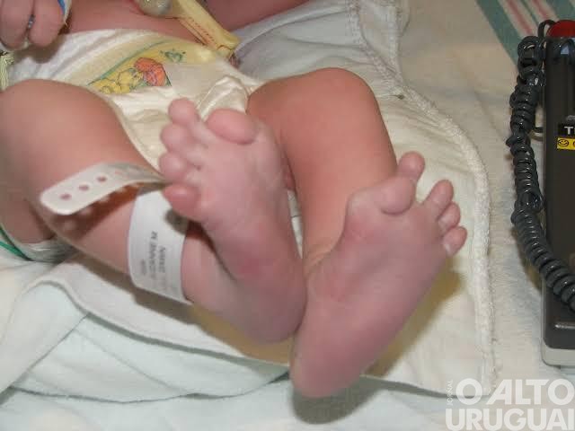 Exame para detectar doença rara em recém-nascidos se torna obrigatório